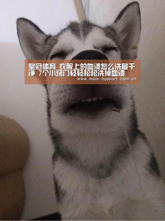 皇冠体育_衣服上的血渍怎么洗最干净 7个小窍门轻轻松松洗掉血渍(图3) 皇冠体育